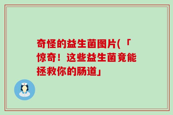 奇怪的益生菌图片(「惊奇！这些益生菌竟能拯救你的肠道」